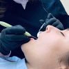 Inactivacion Caries